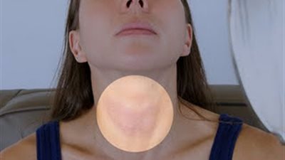 اكتشاف الجينات وراء سرطان الغدد الليمفاوية الأكثر فتكًا