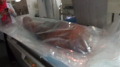 أشعة مقطعية لـ«مومياء» داخل مركز أورام المنيا (صور)