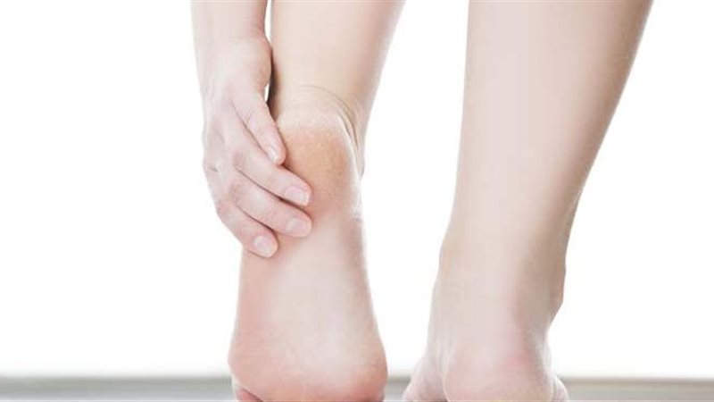 علاج تشقق الكعبين