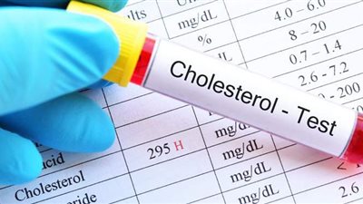 اكتشف أعراض ارتفاع الكوليسترول.. والمواد الطبيعية لخفضه