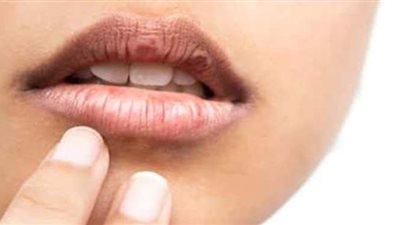 لإظهار جمالك.. وصفة بسيطة للعناية بالشفاه في الشتاء