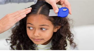 كيفية التخلص من القمل بأسرع وقت