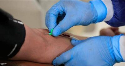 إيطاليا تسجل 37978 إصابة و636 وفاة جديدة بفيروس كورونا