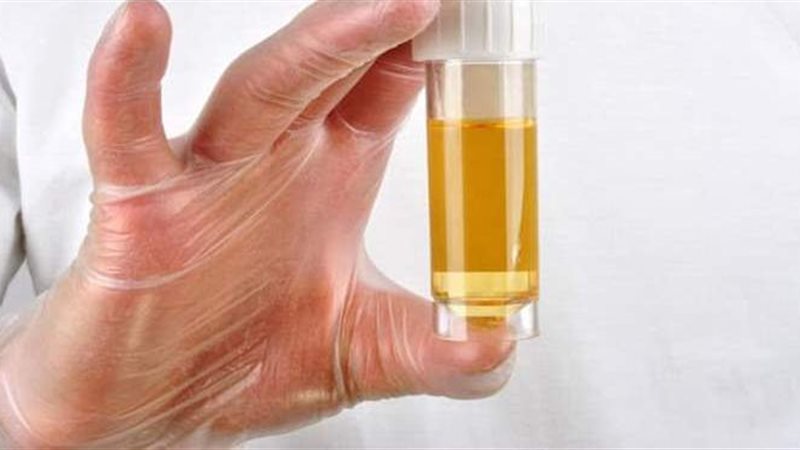 أعراض صديد البول