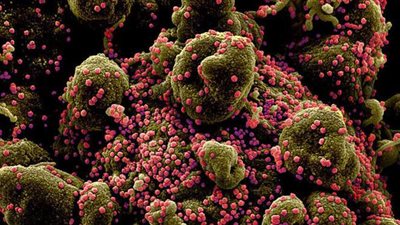 إصابات كورونا في العالم تتجاوز  54 مليونا