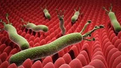 تعرف على أعراض جرثومة المعدة وطرق العلاج والوقاية