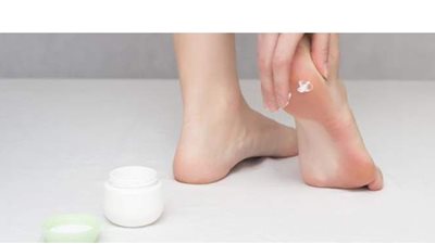 علاجات منزلية للتخلص من تشققات القدمين بدلاً من صالونات التجميل