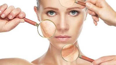 8 طرق لتجنب أضرار السكريات على البشرة