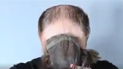 أحدث حيل الرجال للتخلص من الصلع (فيديو)