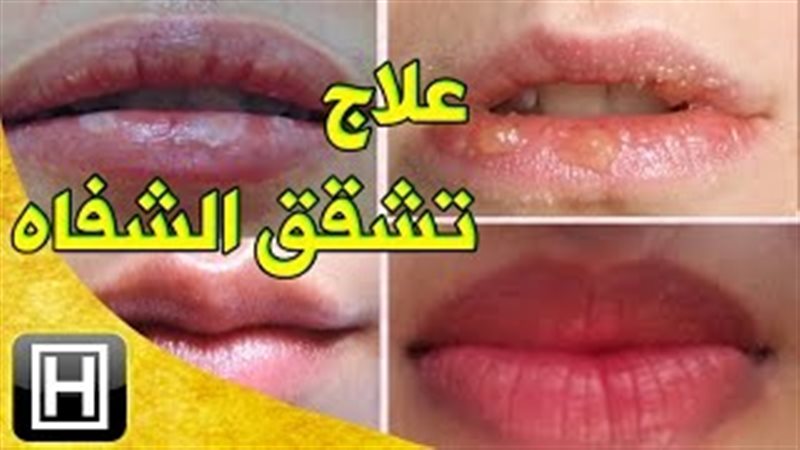 فيتو