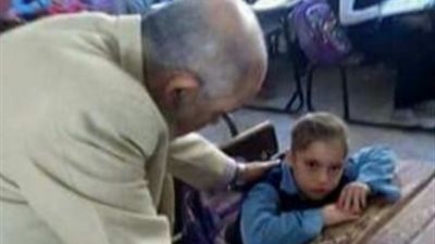 مدير «أبوكبير التعليمية»: «طفلة السرطان» لا تتبع الإدارة