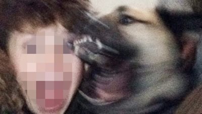 بالصور.. كلب يعض وجه طفل أثناء التقاط صورة لـ«سناب شات»