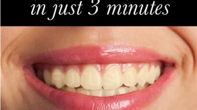 بالفيديو.. أفضل طريقة لتبييض الأسنان في ثلاث دقائق