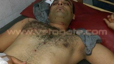 ننشر أول صور لـ«مصابى اعتداءات الإرهابية» في أبوحماد