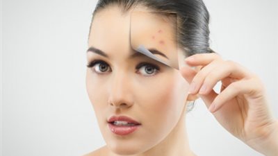 وصفة طبيعية تخلصك من دهون الوجه المتراكمة