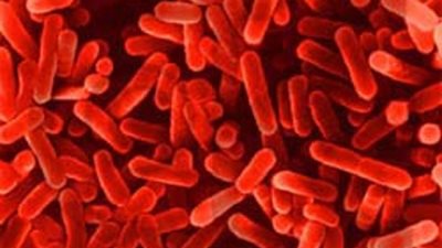 إسفنجة المطبخ تسبب الشلل 