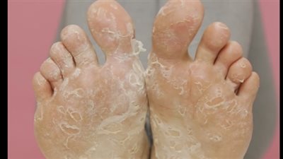 بالفيديو.. 6 حيل جمالية يجب على الفتيات اتباعها