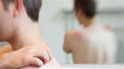 ماذا تعرف عن عدم تحمل الهستامين؟