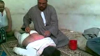 «الوصفة أفضل من الدواء» لعلاج المرضى في القليوبية.. «العقلة» للانزلاق الغضروفي.. «المحجلة» لتأخر الإنجاب.. «الطرقعة» للمصابين بضربة الشمس.. و«وكيل طب بنها&