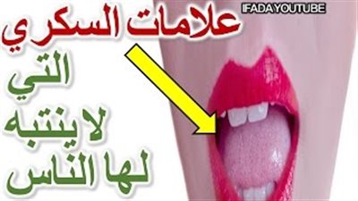 بالفيديو.. 10 علامات تكشف إصابتك بمرض السكري