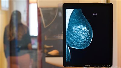 في ألمانيا.. أيدي المكفوفين لتشخيص سرطان الثدي!