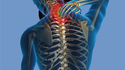 5 أساب تؤدي للإصابة بالانزلاق الغضروفي