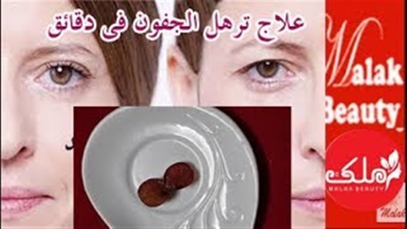 فيتو