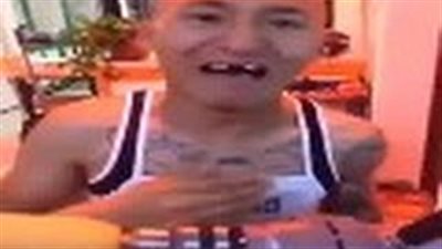 بالفيديو.. رجل يفقد أسنانه بسبب تحدي الذرة والمثقاب