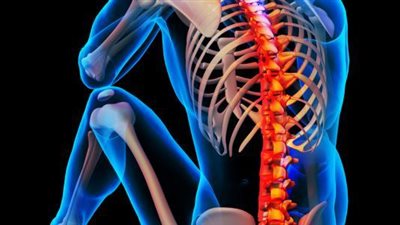 احذر.. السكر يصيبك بضعف العظام وهشاشتها