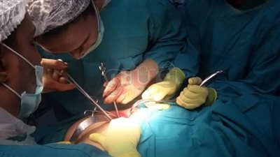 إزالة 47 حصوة من مثانة رجل بمستشفى الغردقة العام (صور)