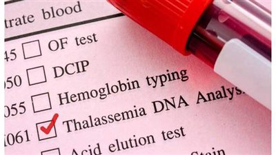 تعرف على أسباب وأعراض الإصابة بأنيميا البحر المتوسط