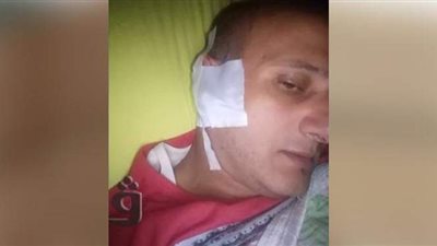 في جلسة صلح.. مواطن يقطع أذن شقيقه بالمنصورة