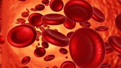 مرض الثلاسيميا.. أعراض الإصابة والعلاج