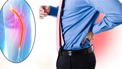 اكتشف أسباب الإصابة بمرض عرق النسا وطرق العلاج