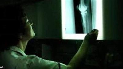 بسبب تكسير العظام.. النباتيون غاضبون من دراسة أكسفورد