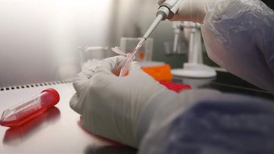 رئيس أقسام الباطنة والمناعة بعين شمس يكشف آخر تطورات لقاح كورونا| فيديو