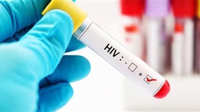 ٤ طرق تنقل فيروس الإيدز.. احذرها