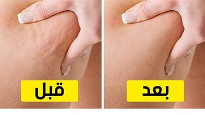 8 أطعمة تناوليها يوميا لتخلصك من السيلوليت
