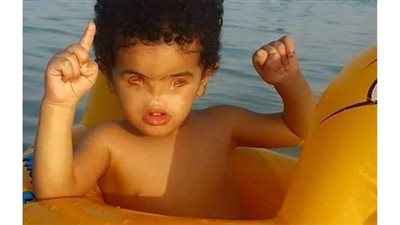 في اليوم العالمي لذوي الاحتياجات الخاصة.. أطفال موهوبون تحدوا العجز.. 