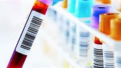 ضبط 27 ألف أمبول سحب دماء منتهية الصلاحية بالساحل