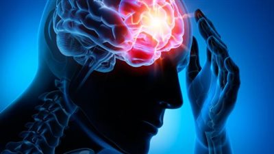 أعراض الإصابة بـ«الصرع» وطرق العلاج