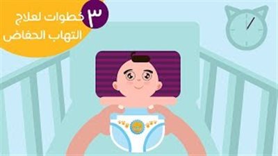 بالفيديو.. 3 خطوات لعلاج التهابات حفاضات طفلك