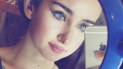 هنا الزاهد تنشر صورة توضح شكل أنفها بعد إجرائها عملية تجميل