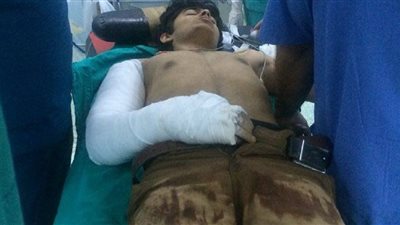 بالصور.. حكومة أردوغان تعالج مقاتلي «داعش» بمستشفيات تركيا