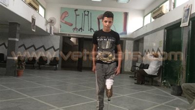 تركيب أجهزة تعويضية لـ7 من ضحايا تفجيرات الشيخ زويد ورفح