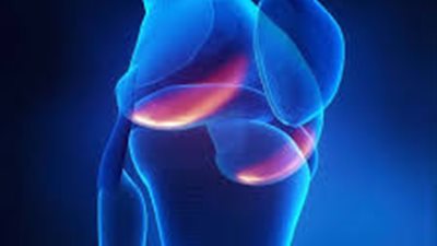 3 أعراض تؤكد الإصابة بهشاشة العظام