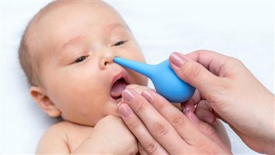 علاج الخنفرة عند الرضع| 7 نصائح لعلاج الخنفرة عند الرضع و 6 أسباب لها