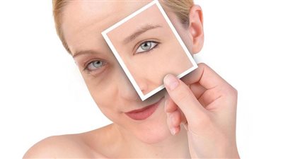 3 وصفات طبيعية تساعد في علاج الهالات السوداء في أسرع وقت