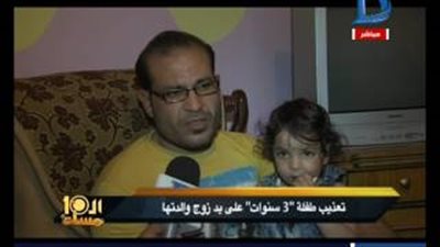 بالفيديو.. حرق طفلة بالسجائر والماء المغلي على يد زوج أمها