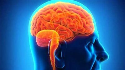 6 إجراءات تساعد فى علاج جلطة المخ